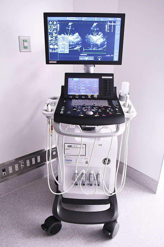 高機能超音波診断装置（エコー）